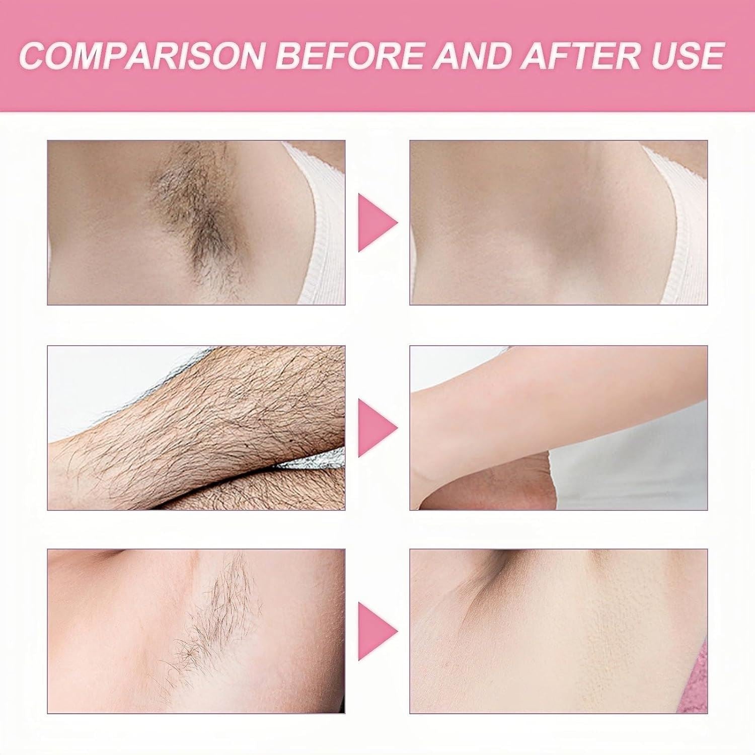 Before and after results using Nuage hair removal cream 6 pack on underarm and arm hair